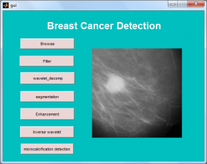 Breast_Cancer_Detection