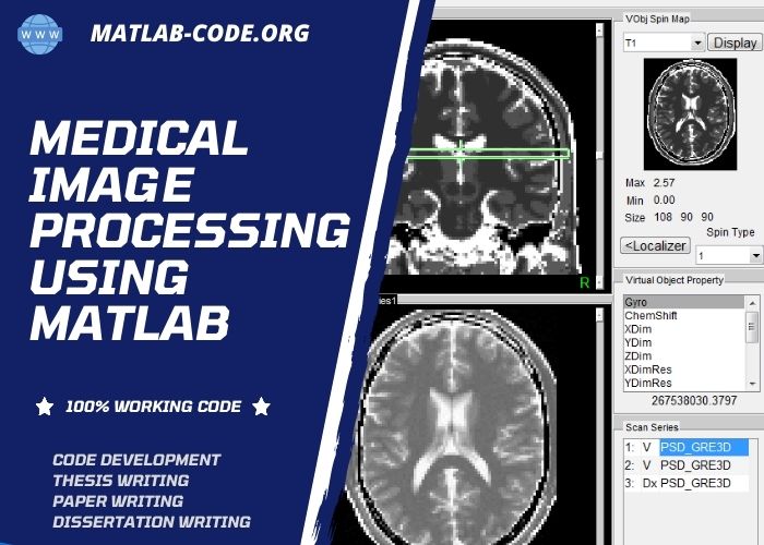 Medical Image Processing Using Matlab Programming With Source Code